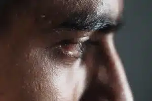 man experiencing cocaine eyes and needing treatment.