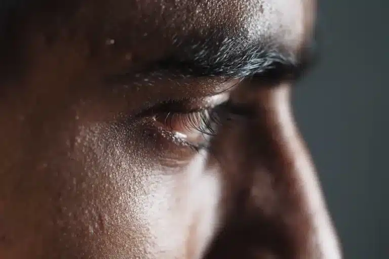 man experiencing cocaine eyes and needing treatment.
